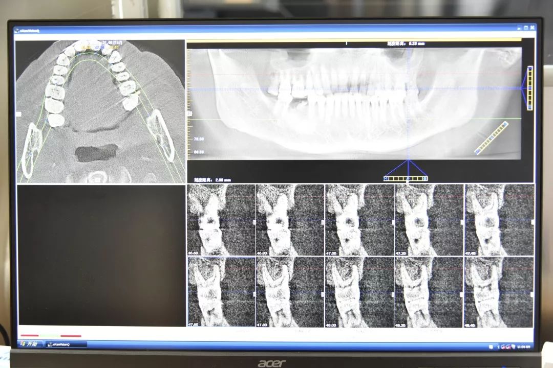 广东省口腔CT技术，探索现代口腔医学的神奇之旅