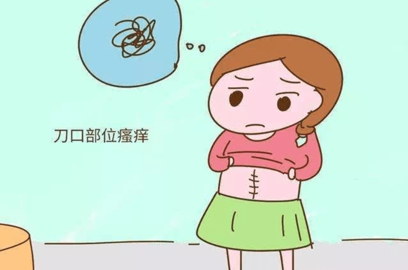 剖腹产三个月后还没来月经，这是怎么回事？