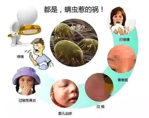 四个月宝宝过敏症状，识别与处理的关键指南